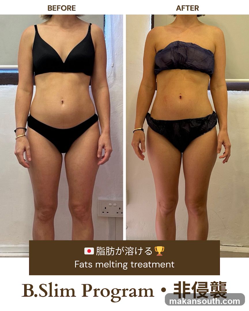 B.Slim Program Before and After