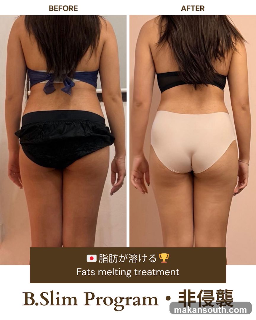 B.Slim Program Before and After