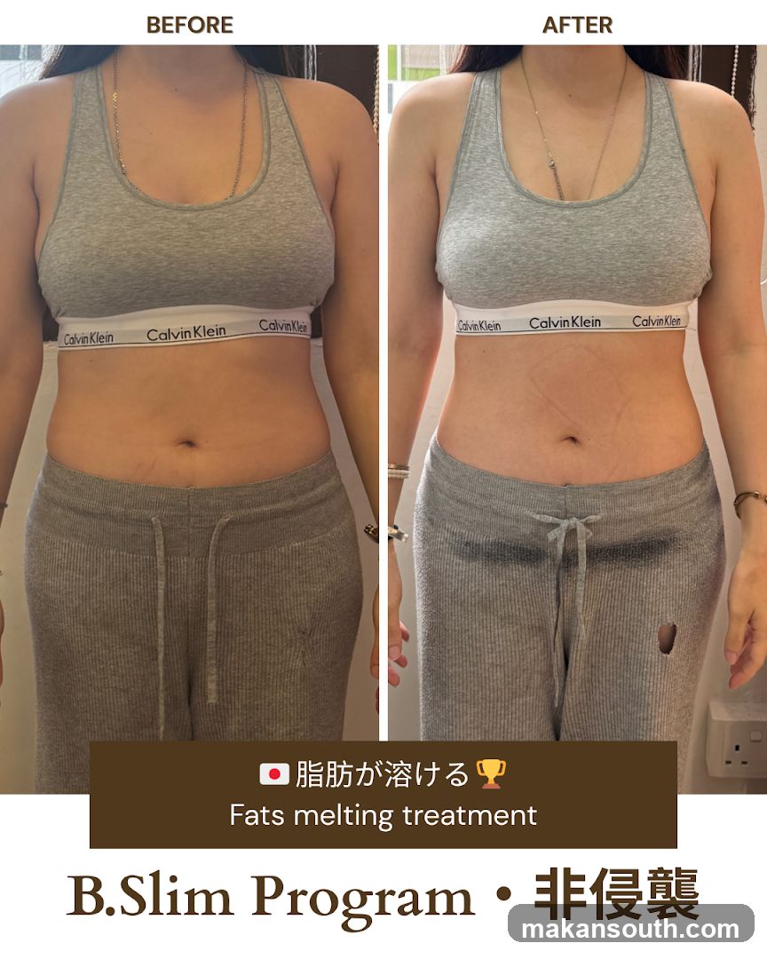 B.Slim Program Before and After Comparison