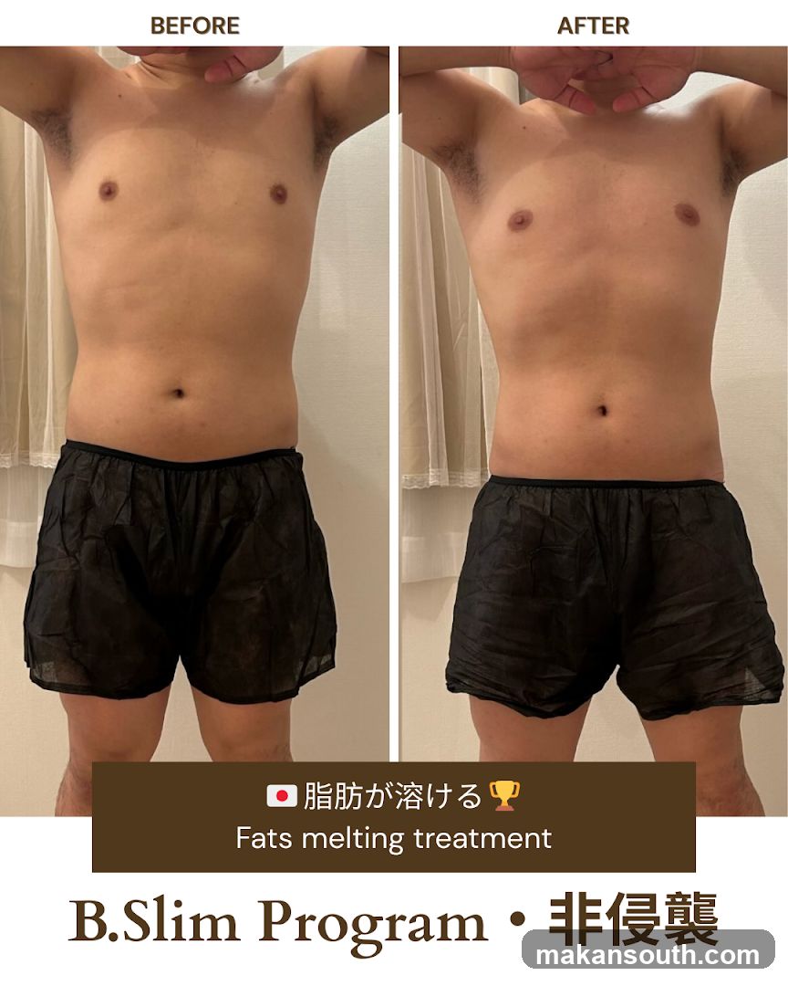 B.Slim Program Before and After Comparison