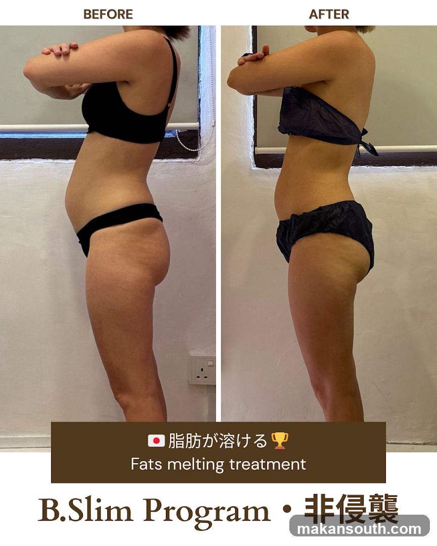 B.Slim Program Before and After