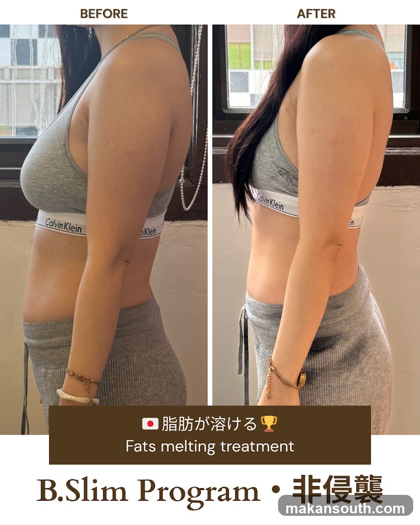 B.Slim Program Before and After Comparison